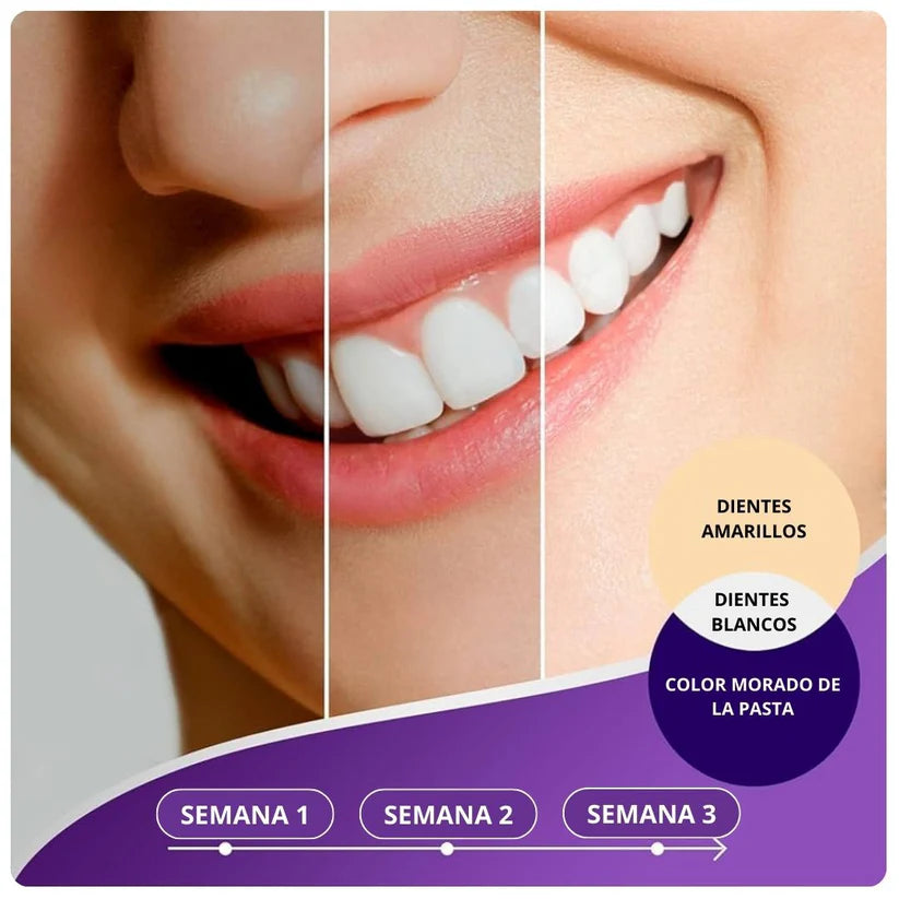 Obsessive Purple V34: Pasta Dental Blanqueadora