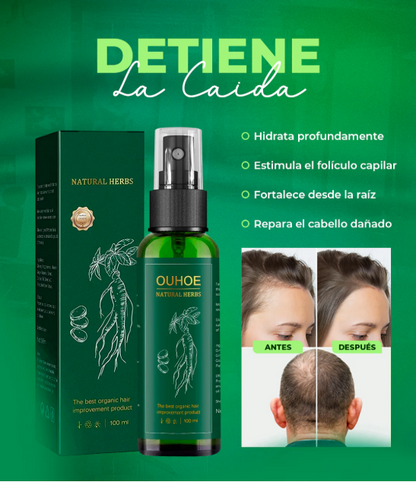 ELIXIR CAPILAR ANTICAIDA