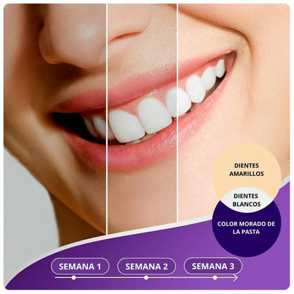 Obsessive Purple V34: Pasta Dental Blanqueadora